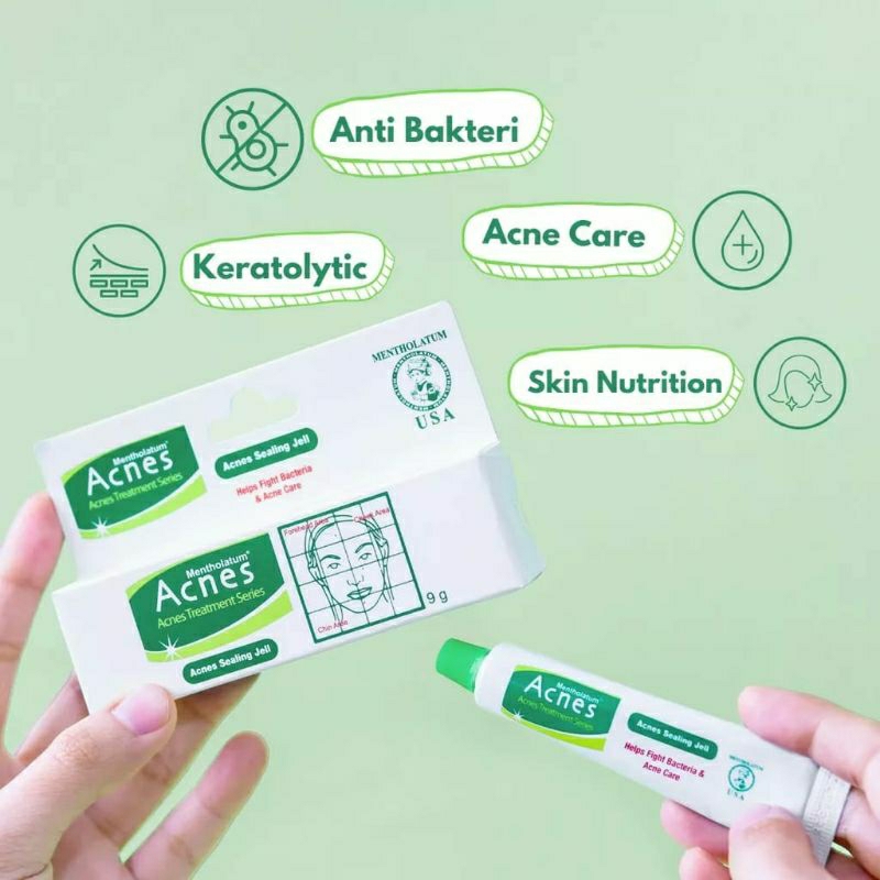 ❤Pinkqueen❤ ACNES SEALING JELL