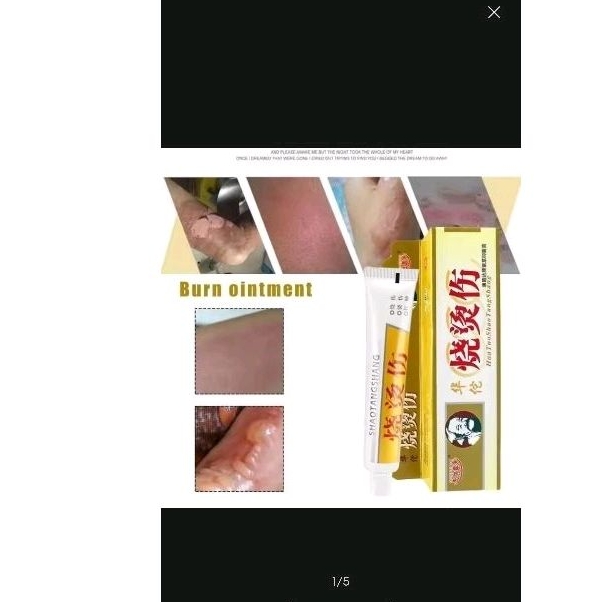Salep obat luka bakar
