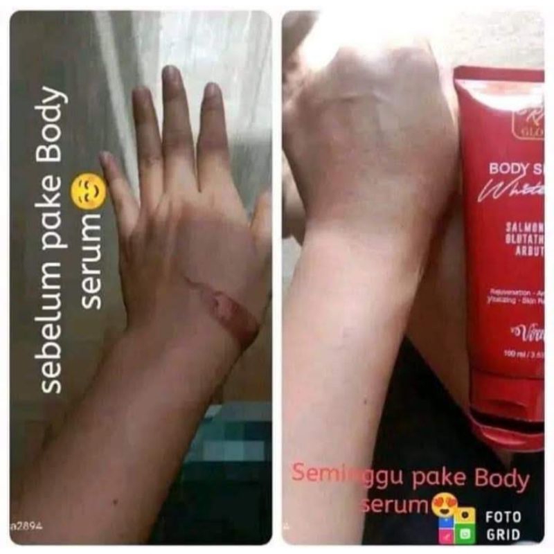 Body Serum RK Glow
