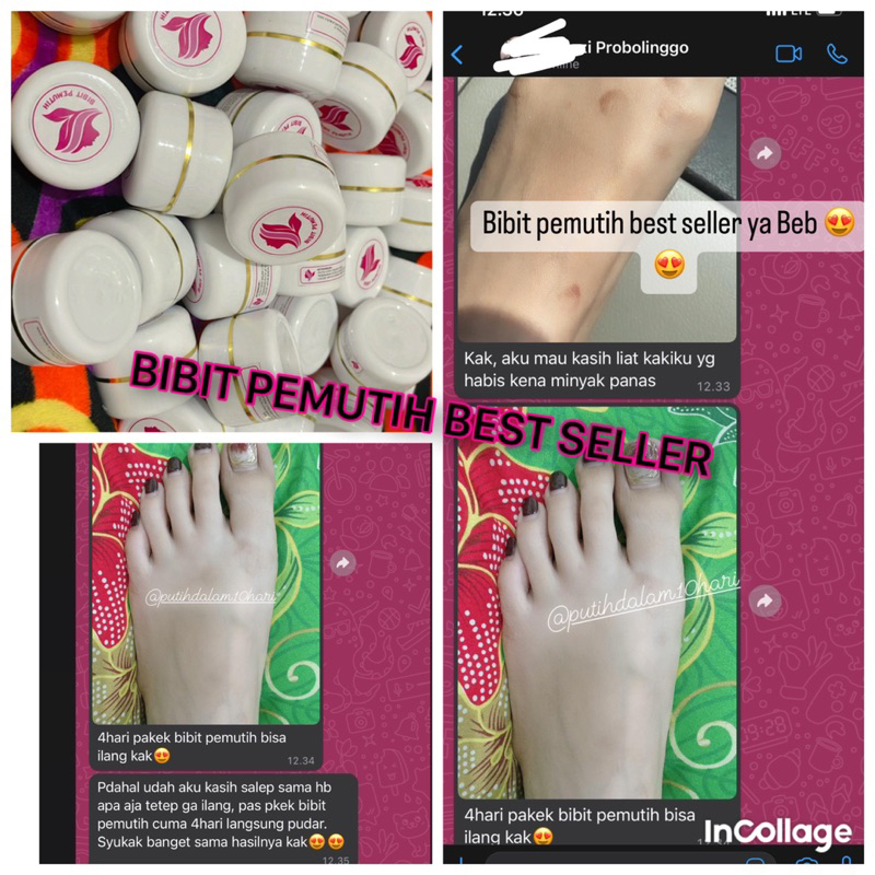 biput whitening