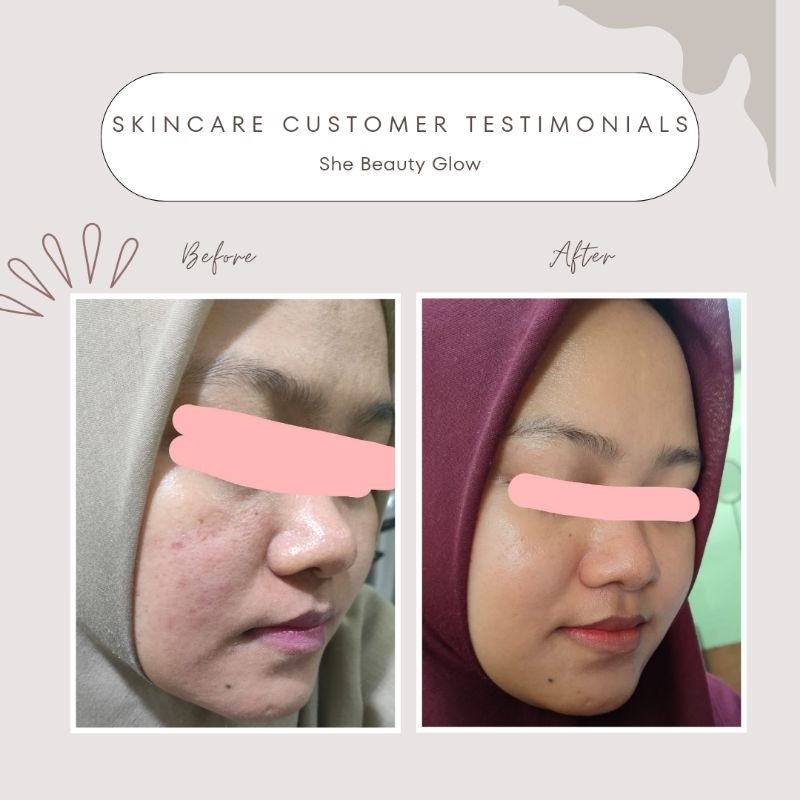 PAKET HEMAT 3IN1
