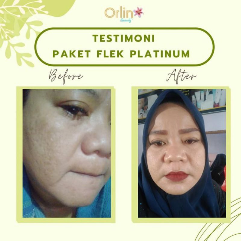 night cream flek platinum