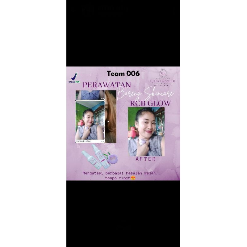 paket Basic pemutih wajah Rcbglow