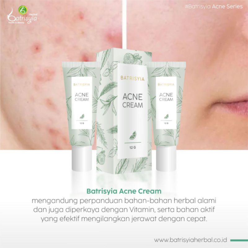 acne cream totol