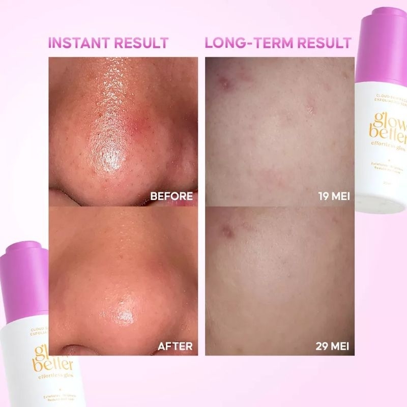 Glow Better Exfoliating Serum
