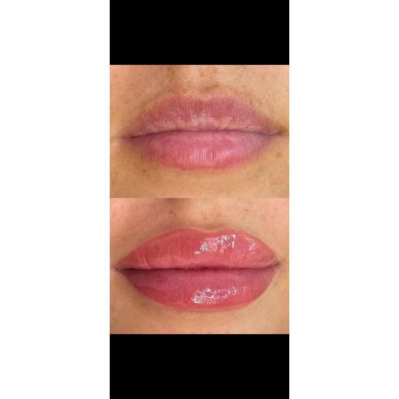 LIP SERUM bibir auto Plumpy