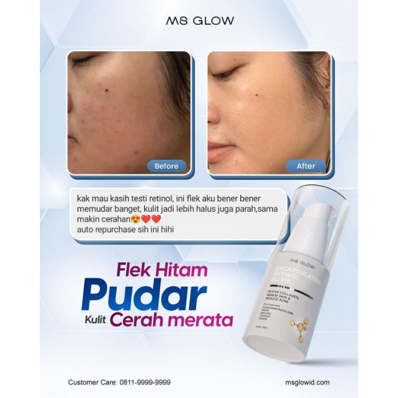 ENCAPSULATED RETINOL ELIXIR