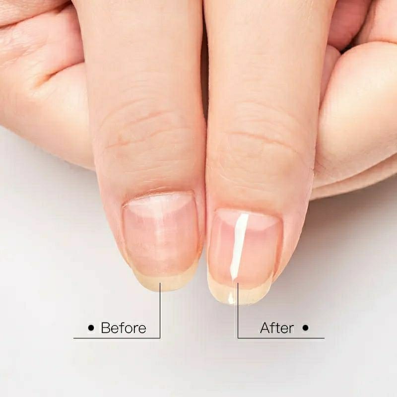Set MTSSII Top coat + Base Coat