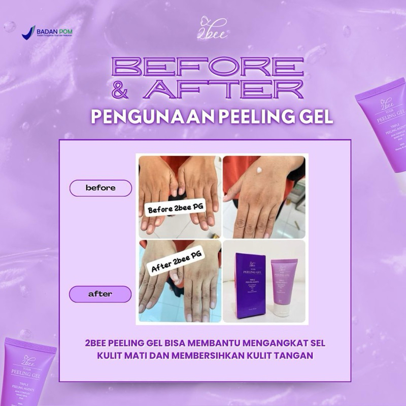 Peeling gel 2 bee