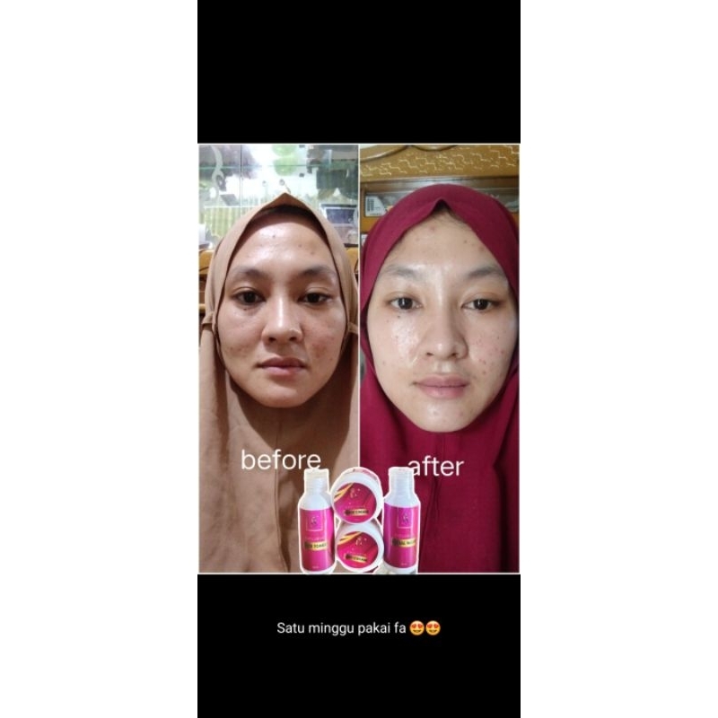 F&A skin Glow