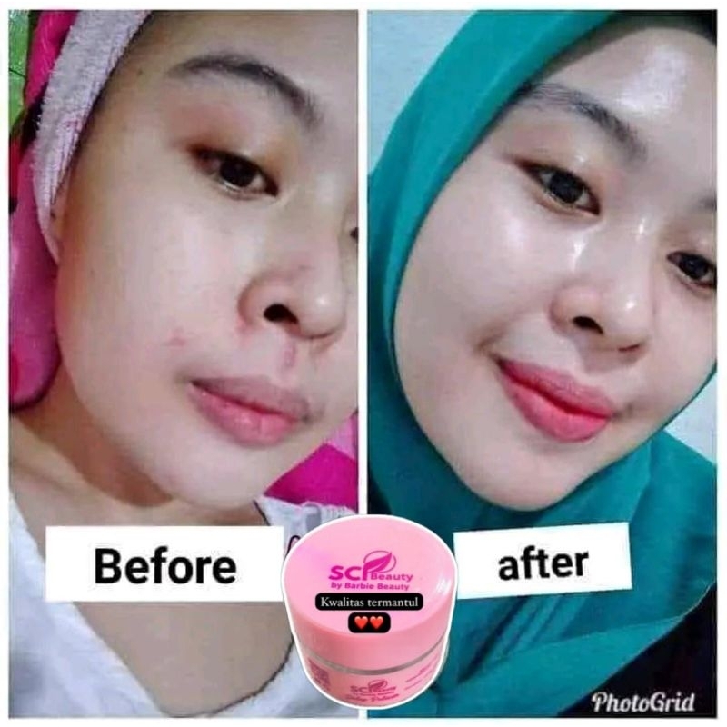 SALEP PELICIN SCI KEMASAN TERBARU