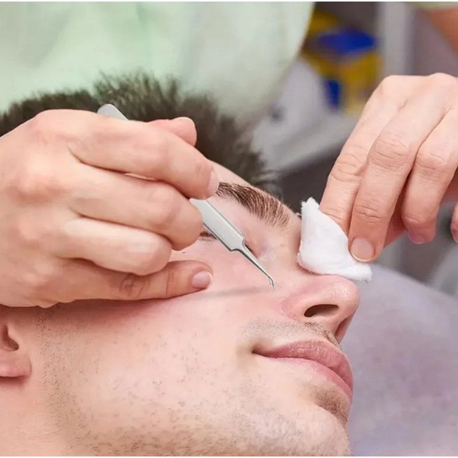 FACIAL BLACKHEAD REMOVER PSM