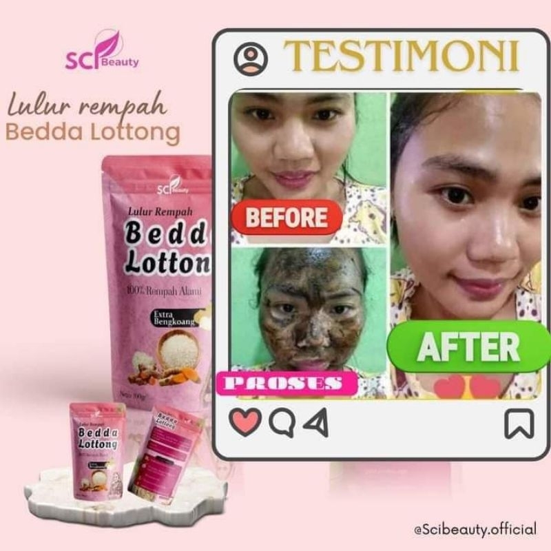 Bedda Lottong SCI