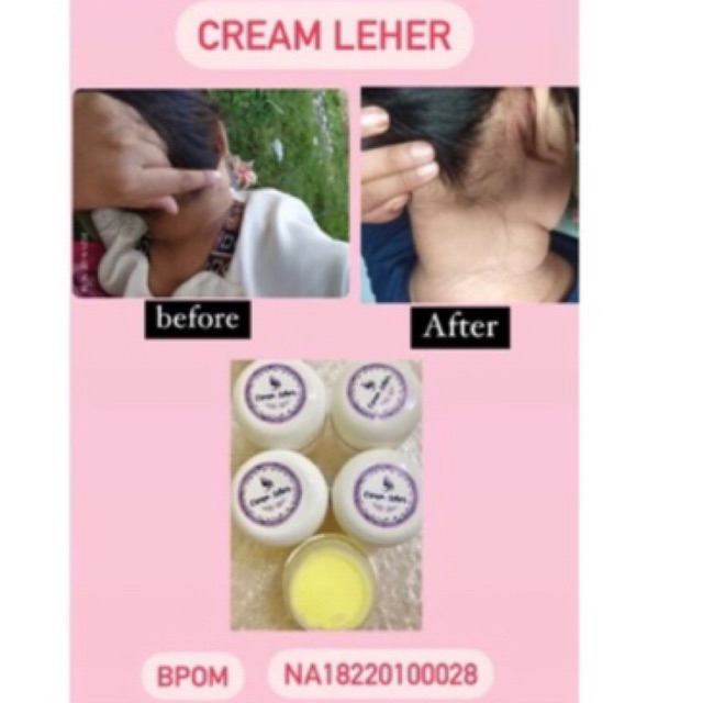 CREAM PEMUTIH LEHER BPOM