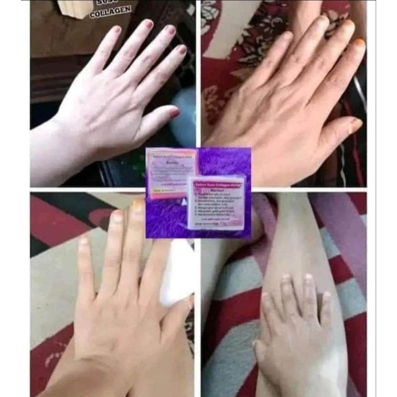 sabun susu collagen