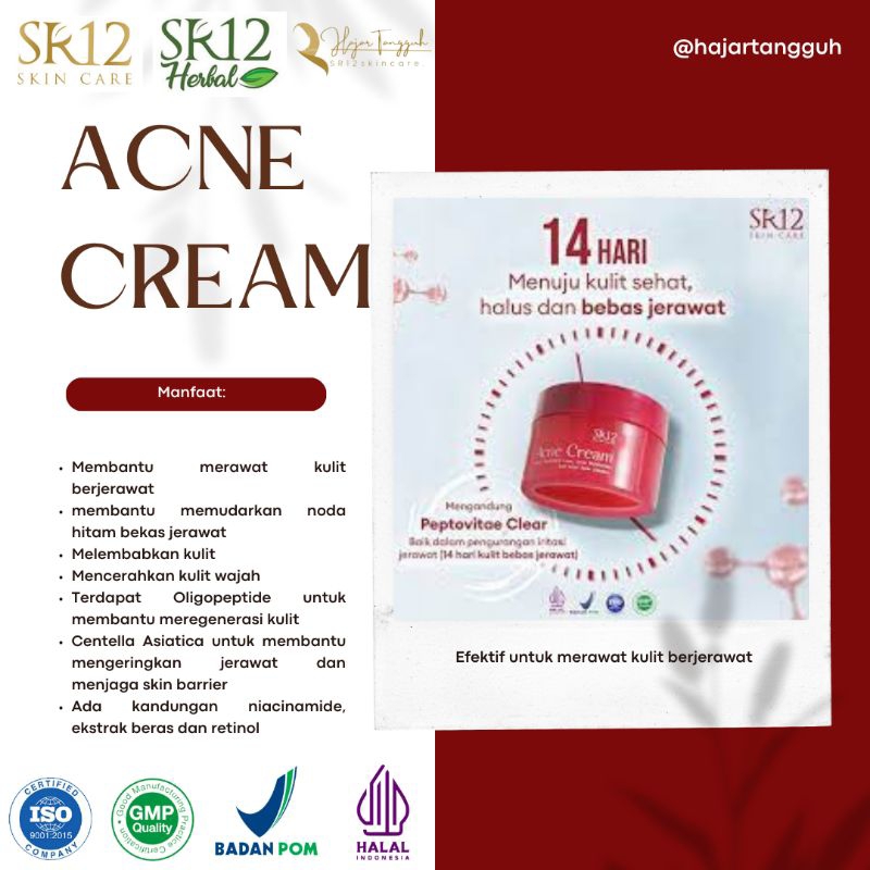 Acne Cream