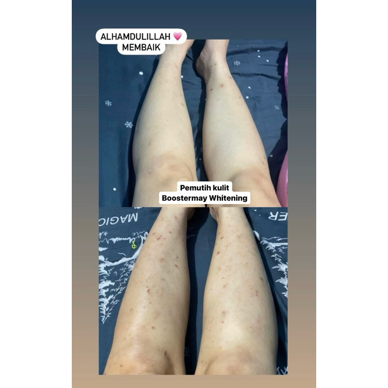 BOOSTERMAY PEMUTIH BADAN