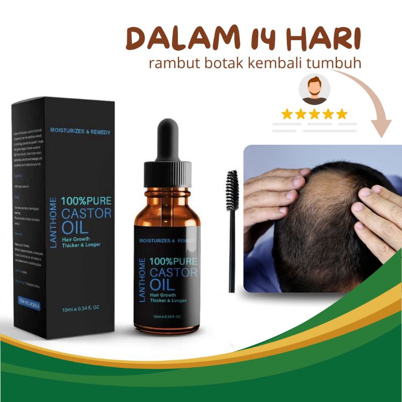𝗦𝗲𝗿𝘂𝗺 𝗽𝗲𝗻𝘂𝗺𝗯𝘂𝗵 𝗿𝗮𝗺𝗯𝘂𝘁 & 𝗮𝗹𝗶𝘀, 𝗖𝗮𝘀𝘁𝗼𝗿 𝗢𝗶𝗹 𝟭𝟬𝟬% 𝗢𝗿𝗶𝗴𝗶𝗻𝗮𝗹 𝗚𝗿𝗼𝘄𝘁𝗵 𝗛𝗮𝗶𝗿