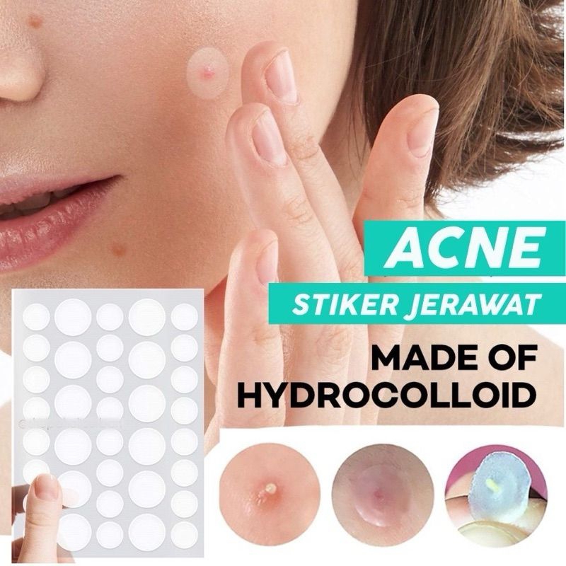 Acne Patch 36pcs Sticker Penghilang Jerawat