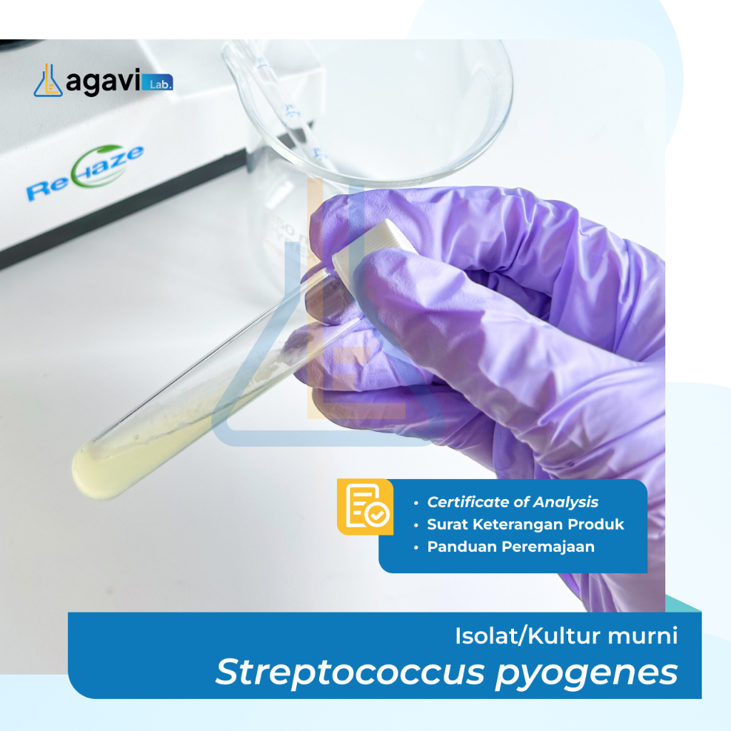 Isolat/Kultur Murni Streptococcus pyogenes