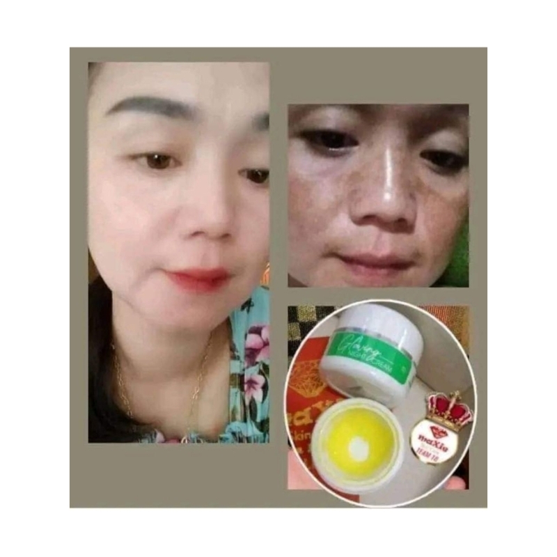 cream flek maxie ori