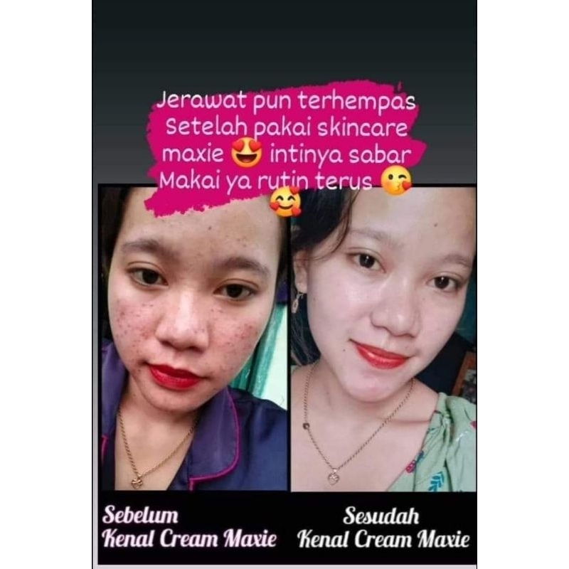 SEKINCER BPOM MAXIE