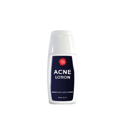 Viva Acne Lotion 30ml