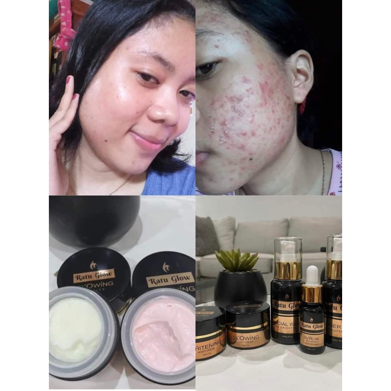 RATU GLOW PLATINUM