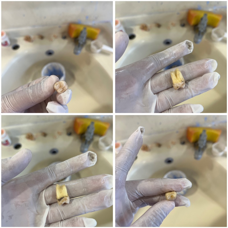gigi molar
