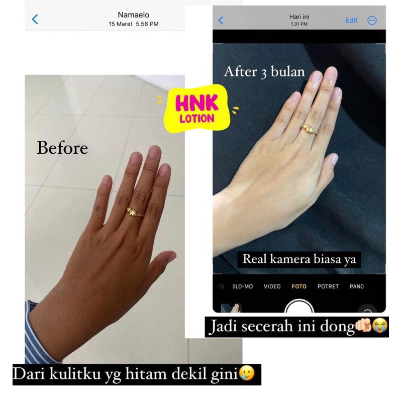 HNK body lotion