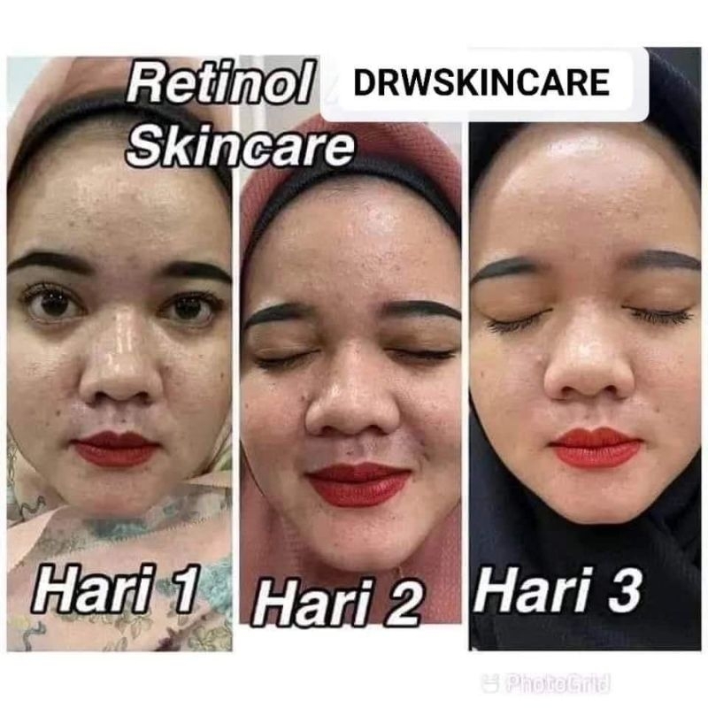 serum retinol