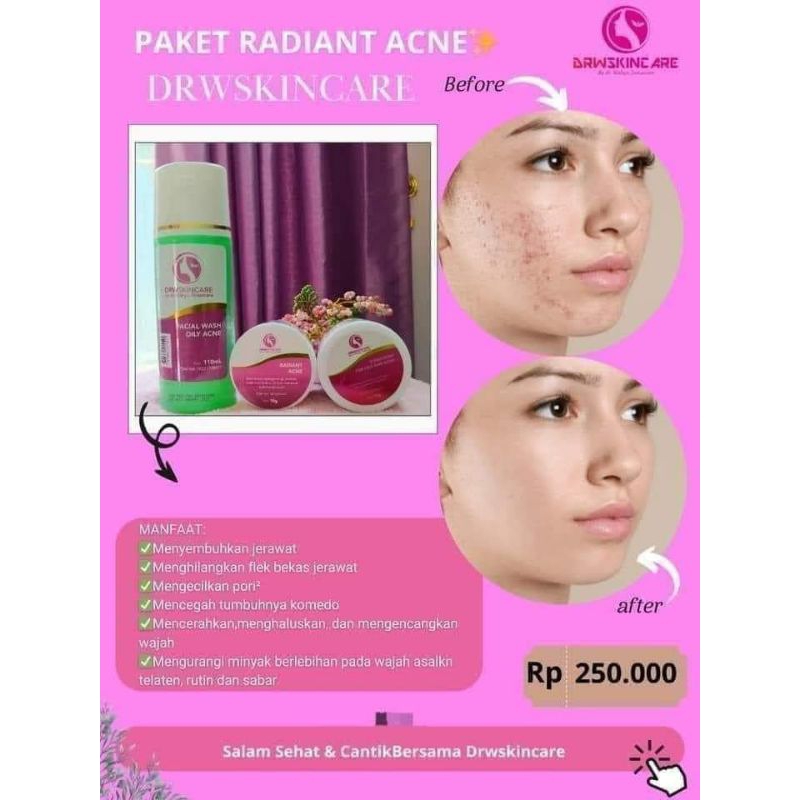 Paket standar Radiant Acne