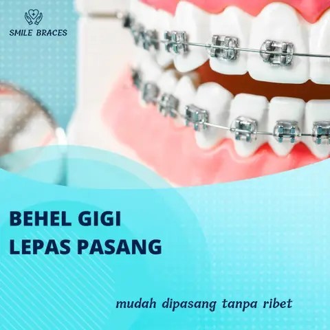 Behel Gigi