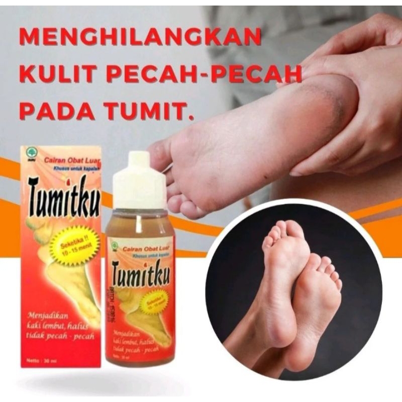 {TERLARIS}TUMITKU/kakipecahpecah