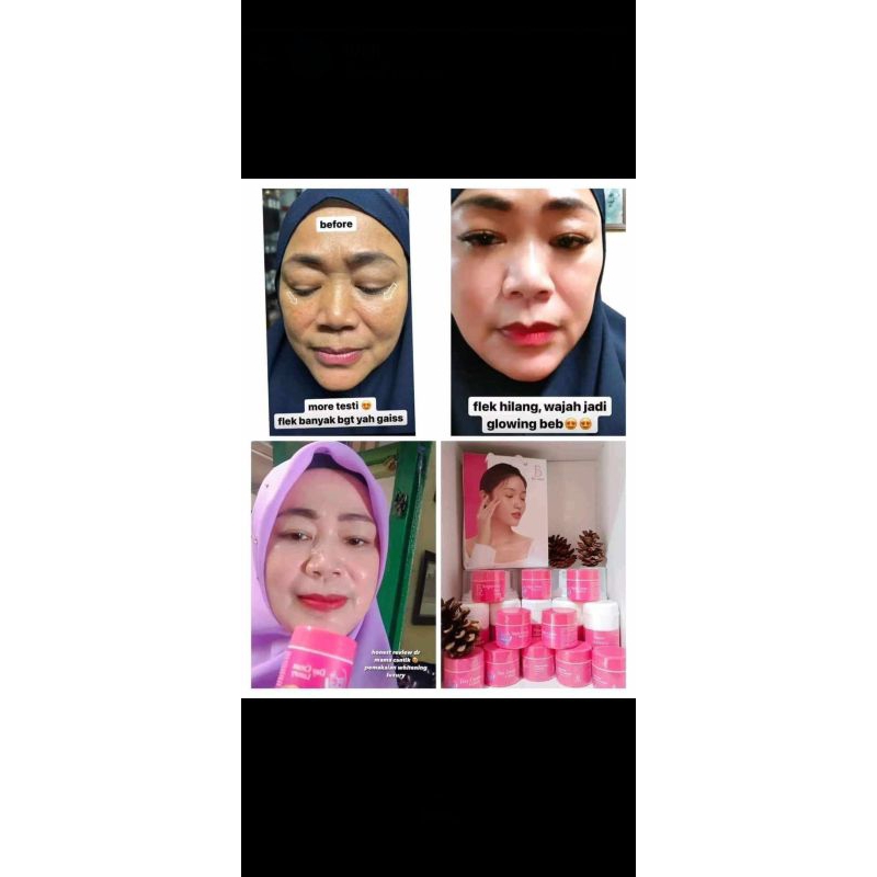 Paket Brightening(paket flek)