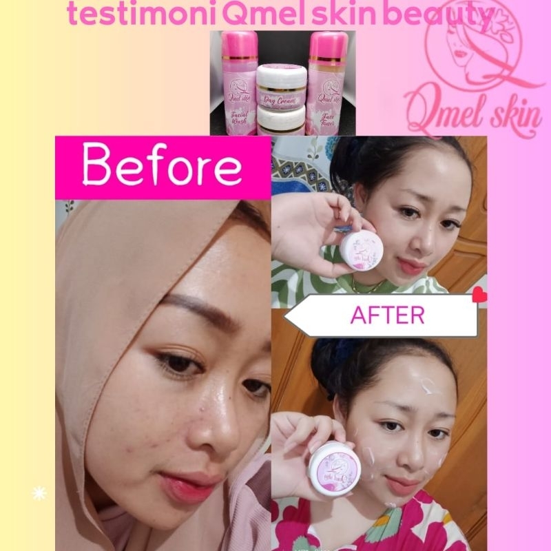 Qmel Skin