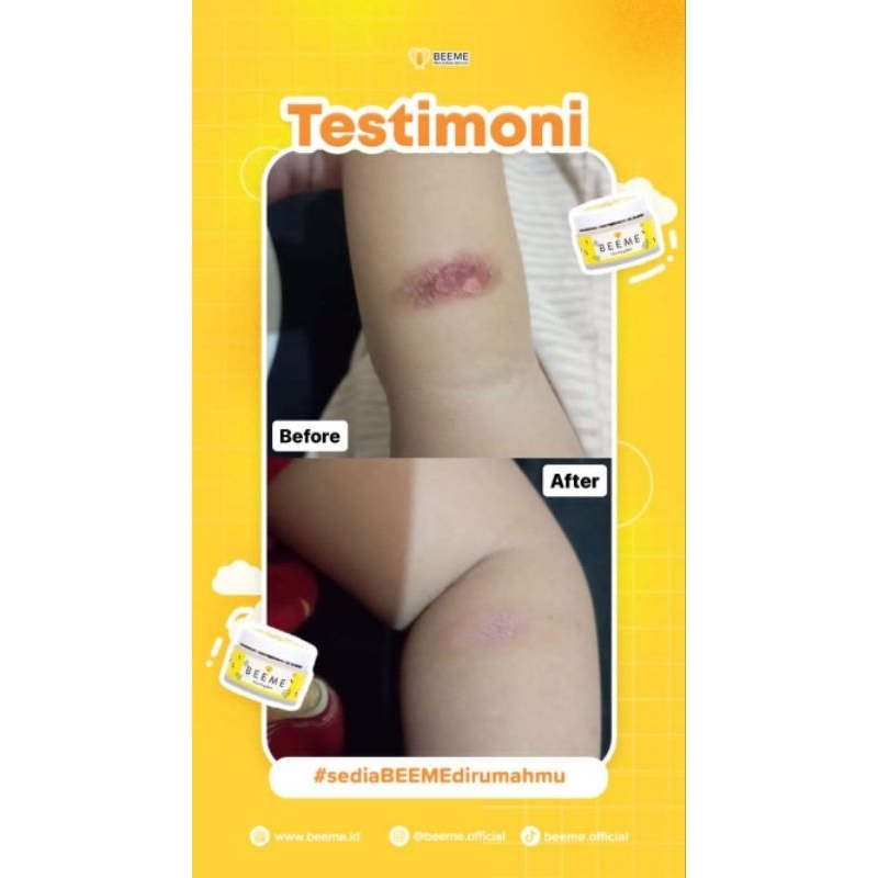 BEEME NOURISHING BALM