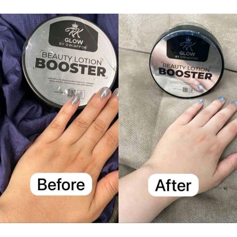 boster rk