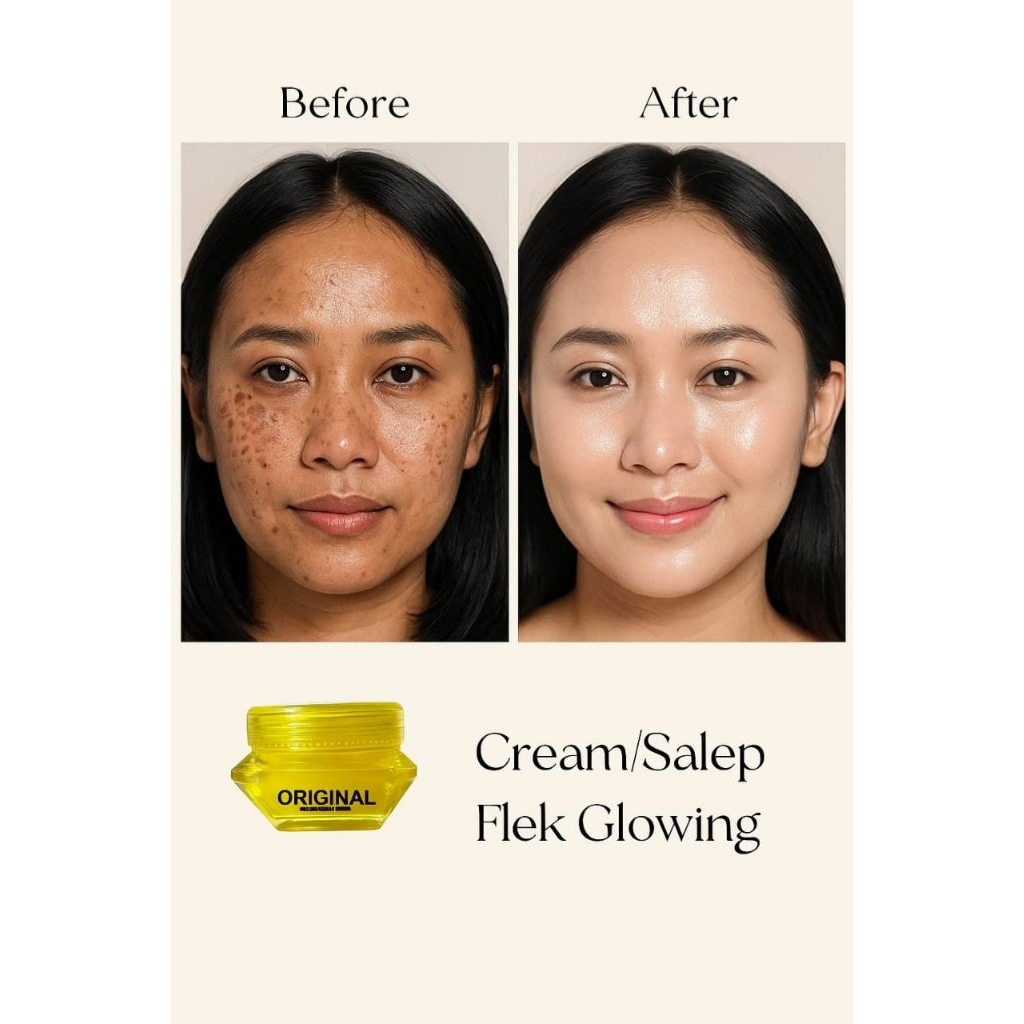 Salep flek glowing / cream glowing flek