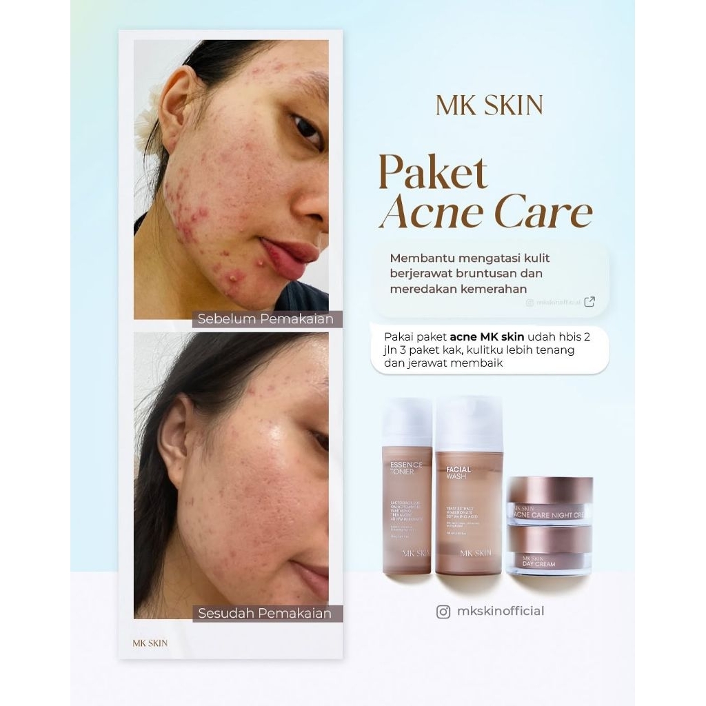 MK SKIN ACNE