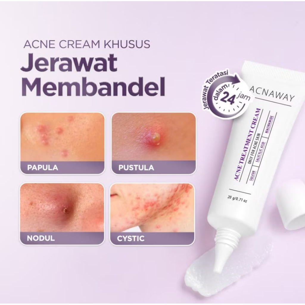 ACNAWAY ACNE TREATMENT
