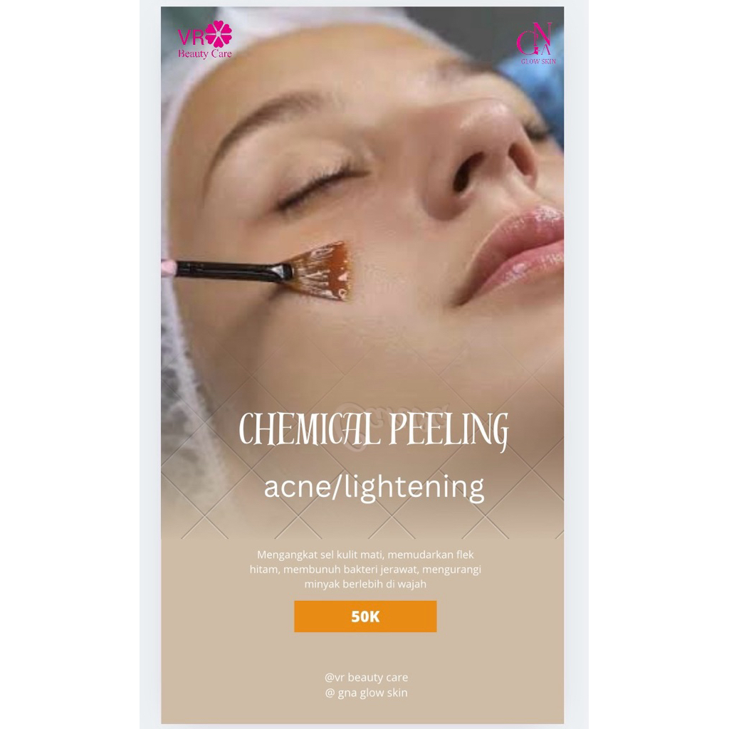 Chemicall peeling acne/lightening