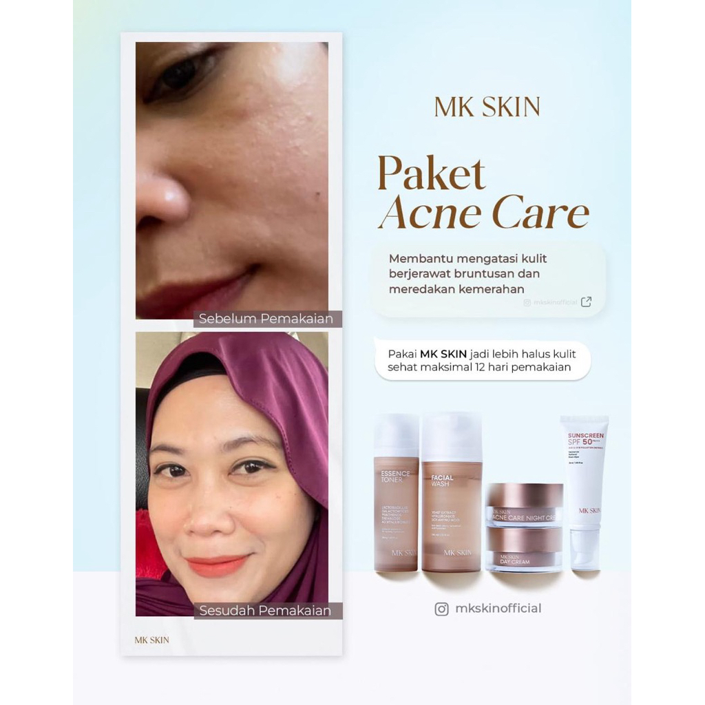 MK SKIN PAKET ACNE