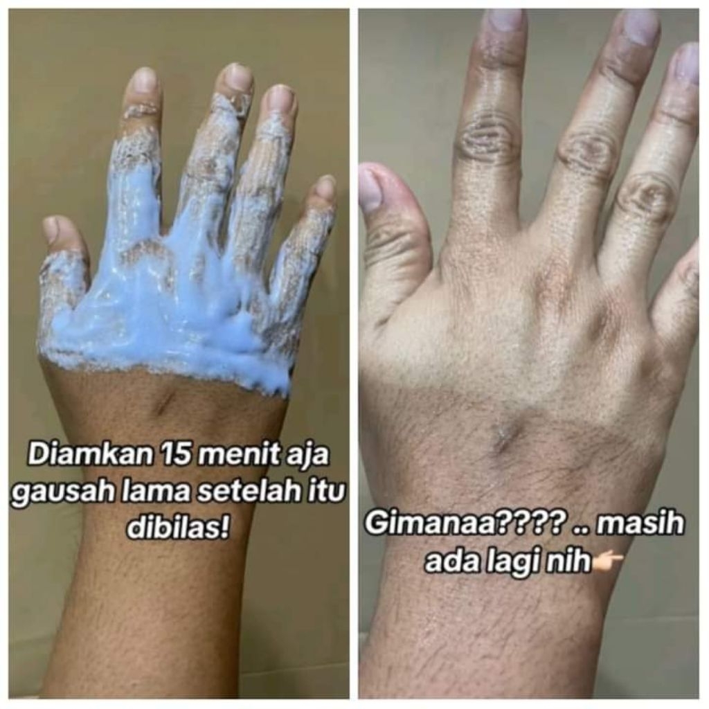 BLECING DOSTIN BADAN