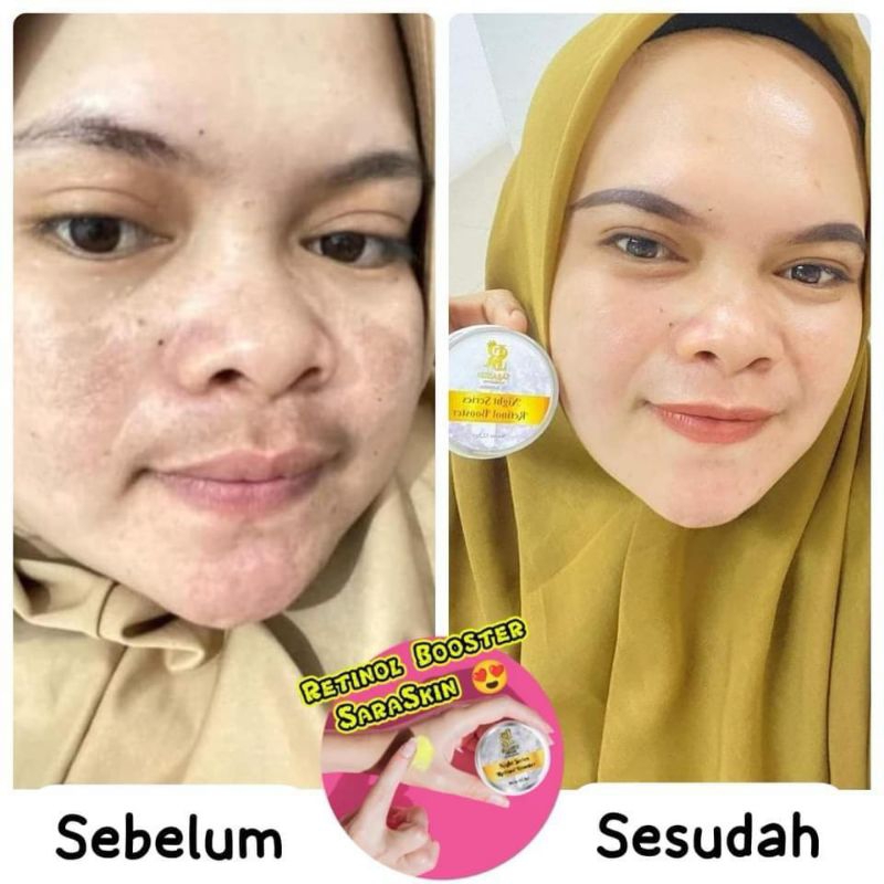 retinol boster