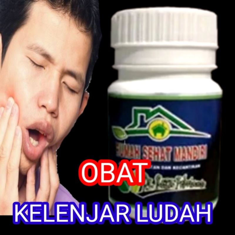 OBAT KELENJAR LUDAH