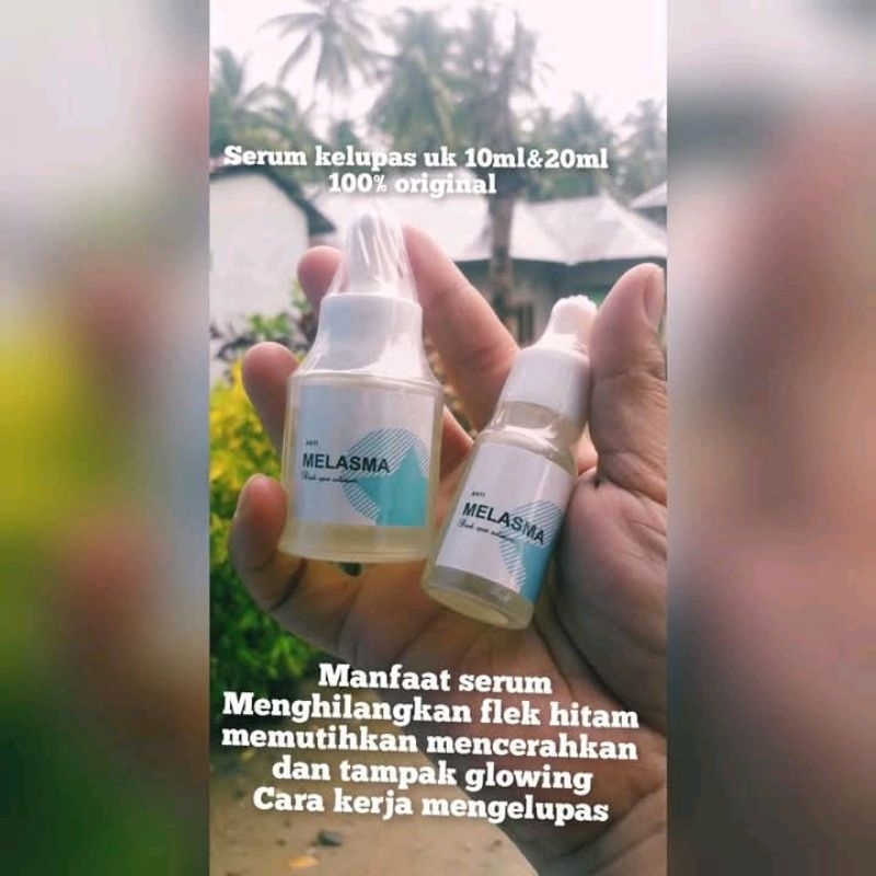 beauty melasma