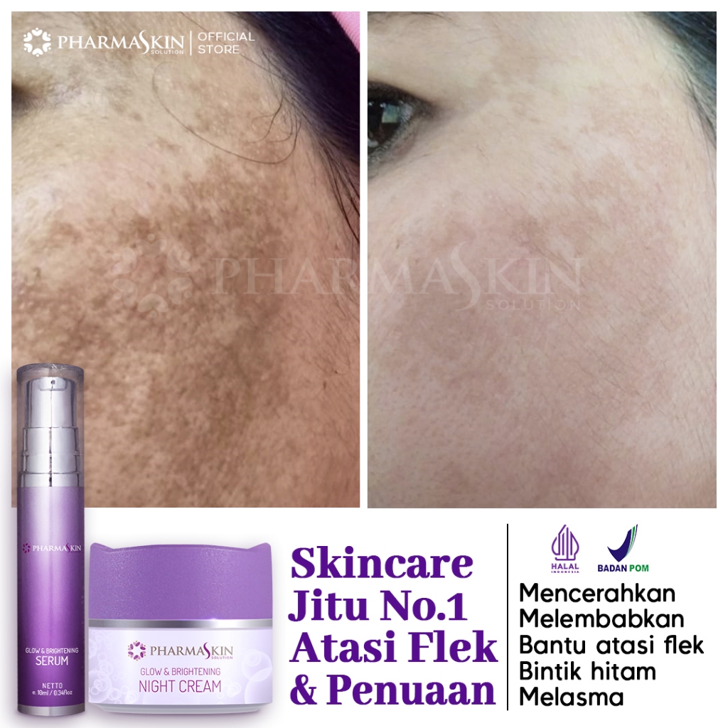 Perawatan Dasar Spesialis Flek Menahun by Pharmaskin Solution