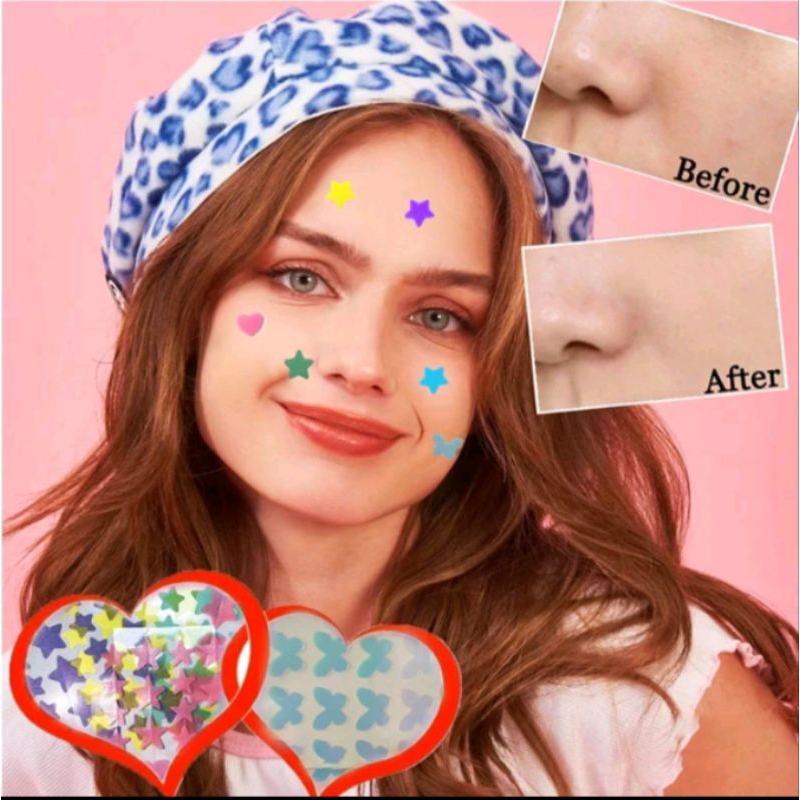 Acne Patch Pimple Patch Hydrocolloid Penghilang Jerawat
