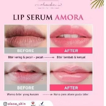 LIP SERUM